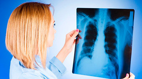 Roadmap of international partnership to fight TB drawn up in Minsk