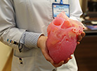 3D heart model