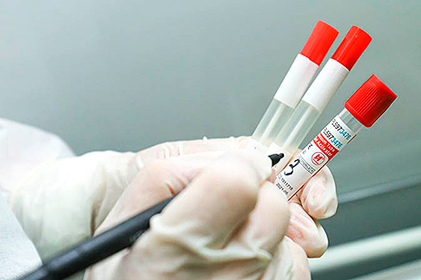 Belarus’ coronavirus update: 77,423 patients recover