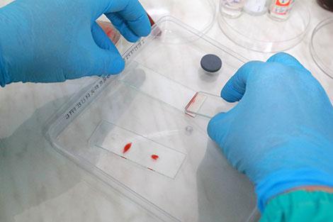 Беларусь получила пробную партию экспресс-тестов на антитела к коронавирусу
