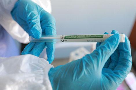 Минздрав планирует закупку экспресс-тестов на коронавирус COVID-19