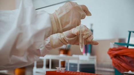 За суткі ў Беларусі зарэгістравана 1911 пацыентаў з COVID-19, выпісана 1658