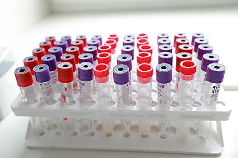 За суткі ў Беларусі зарэгістраваны 914 пацыентаў з COVID-19, выпісаны 919