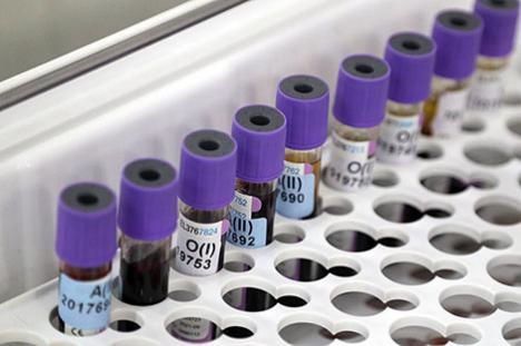 За суткі ў Беларусі зарэгістраваны 1834 пацыенты з COVID-19, выпісаны 2024