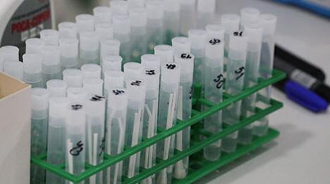 У Беларусі выздаравелі і выпісаны больш як 76 тыс. пацыентаў з COVID-19