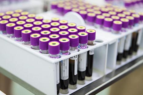 За суткі ў Беларусі зарэгістраваны 1922 пацыенты з COVID-19, выпісаны 2272