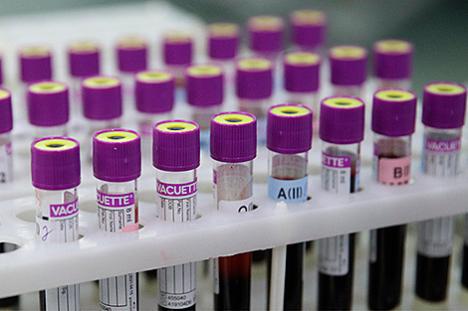 За суткі ў Беларусі зарэгістраваны 1647 пацыентаў з COVID-19, выпісаны 510