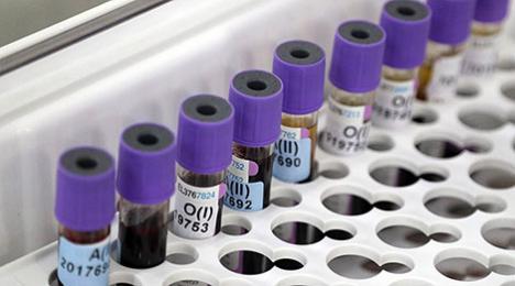 За суткі ў Беларусі зарэгістраваны 475 пацыентаў з COVID-19, выпісаны 267