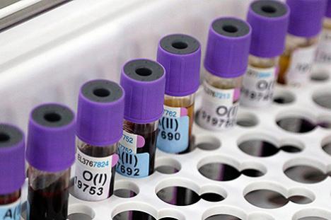 За суткі ў Беларусі зарэгістраваны 847 пацыентаў з COVID-19, выпісаны 754