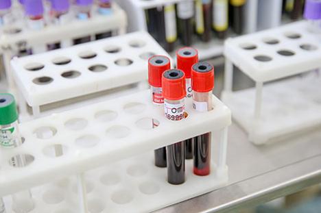 У Беларусі выздаравелі і выпісаны 74 525 пацыентаў з COVID-19