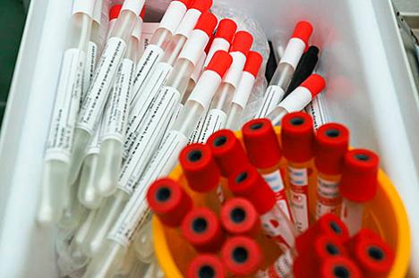 За суткі ў Беларусі зарэгістраваны 609 пацыентаў з COVID-19, выпісаны 564