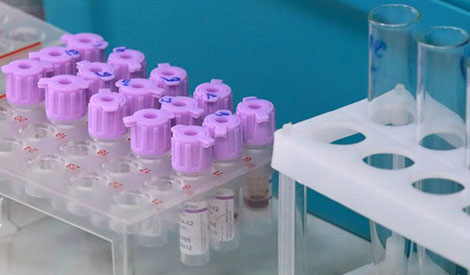 白罗斯生产的几种冠状病毒诊断试剂系统正在通过试验