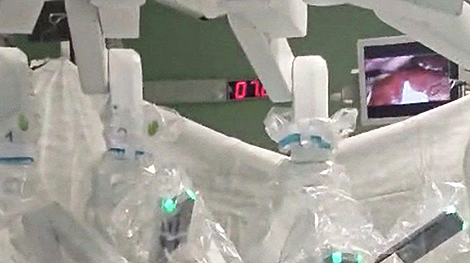 明斯克完成首例机器人肝脏切除术