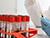 Wochenblick: Lukashenko was right to refrain from coronavirus lockdown
